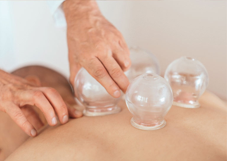 Anemia cupping therapy