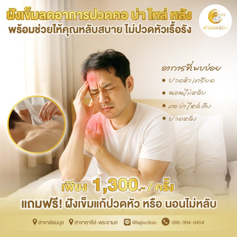 โปรโมชั่น ฝังเข็ม ปวดหัว ปวดคอบ่าไหล่ ออฟฟิศซืนโดรม