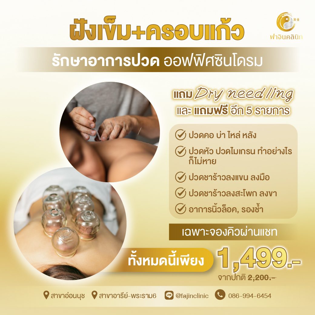 ฝังเข็ม ครอบแก้ว แก้ปวด ออฟฟิศซินโดรม