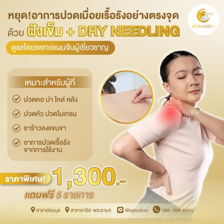 ฝังเข็ม dry needling แก้ปวด ออฟฟิศซินโดรม