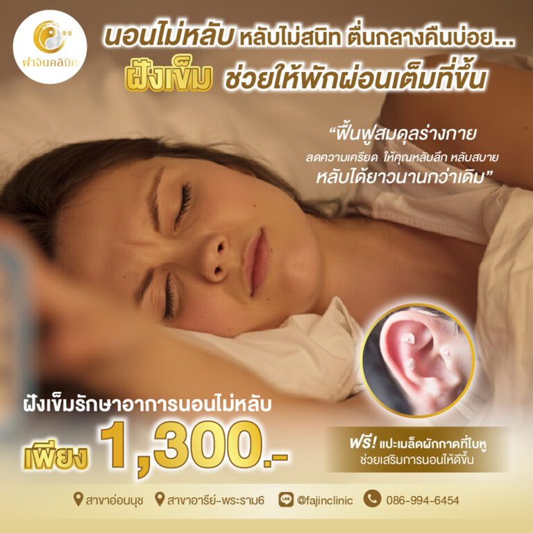 โปรโมชั่น ฝังเข็ม ฝังเข็มรักษาโรค นอนไม่หลับ หลับไม่สนิท