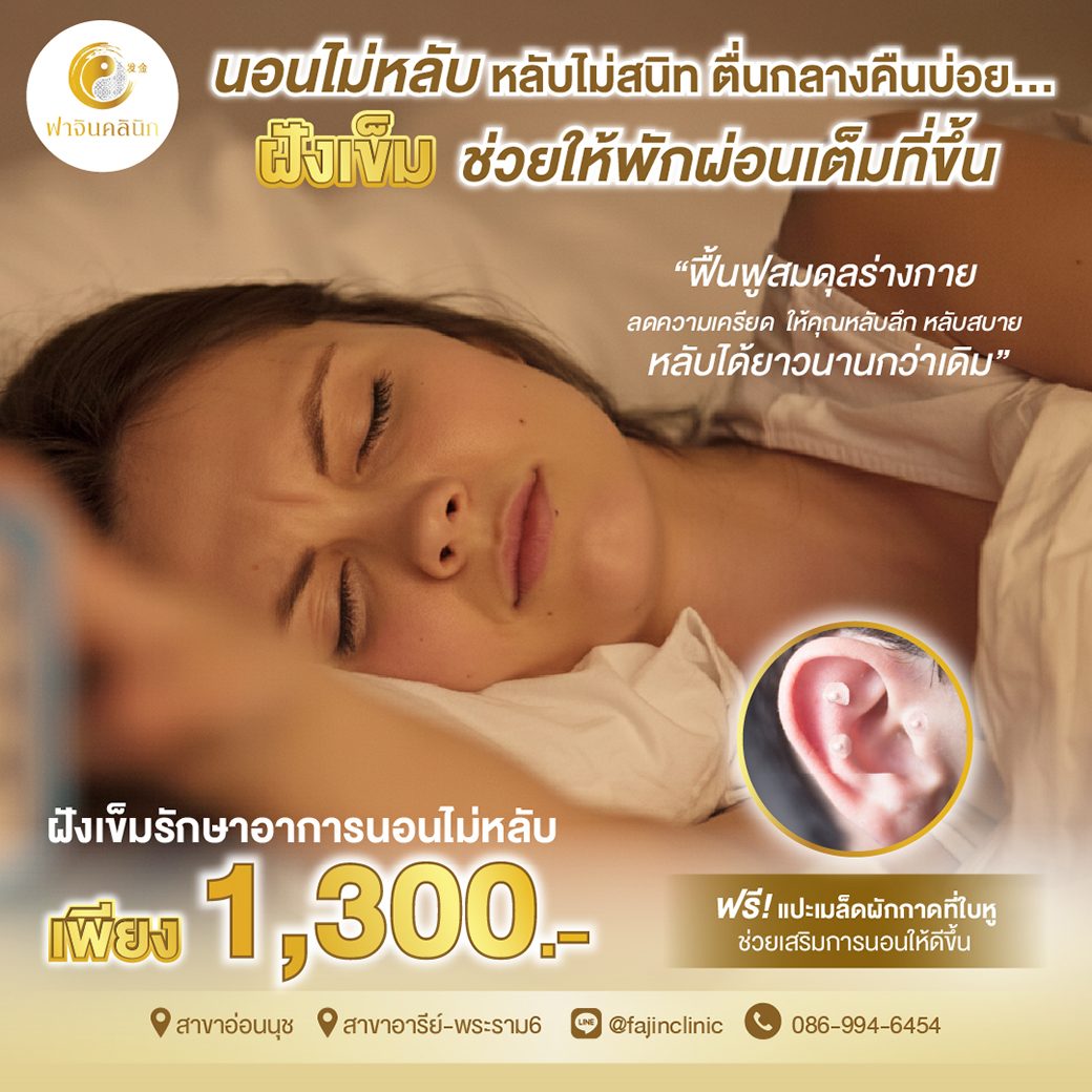 โปรโมชั่น ฝังเข็ม ฝังเข็มรักษาโรค นอนไม่หลับ หลับไม่สนิท