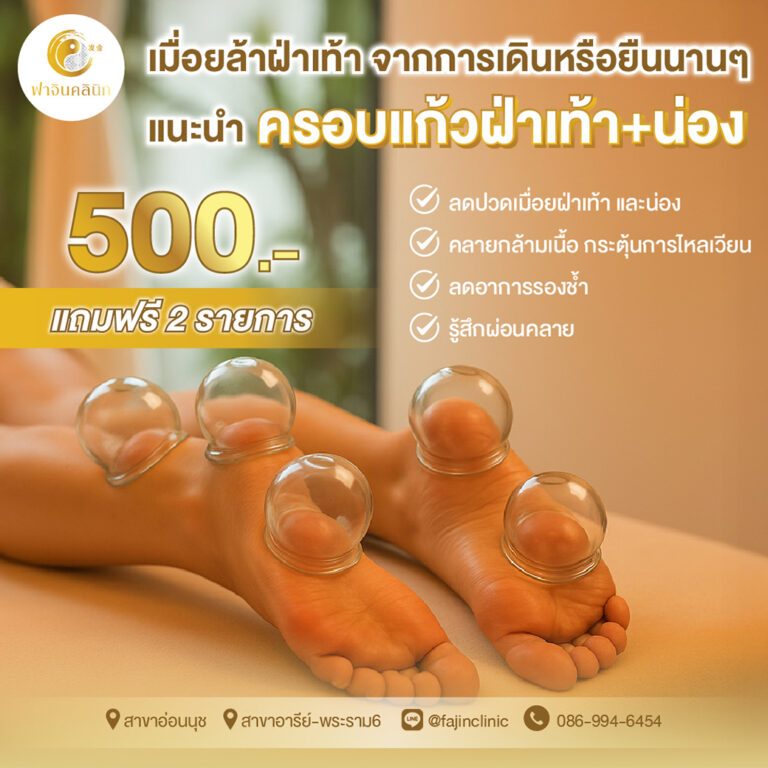 โปรโมชั่นครอบแก้ว แก้ปวด ฝ่าเท้า น่อง รองช้ำ ครอบแก้วฝ่าเท้า