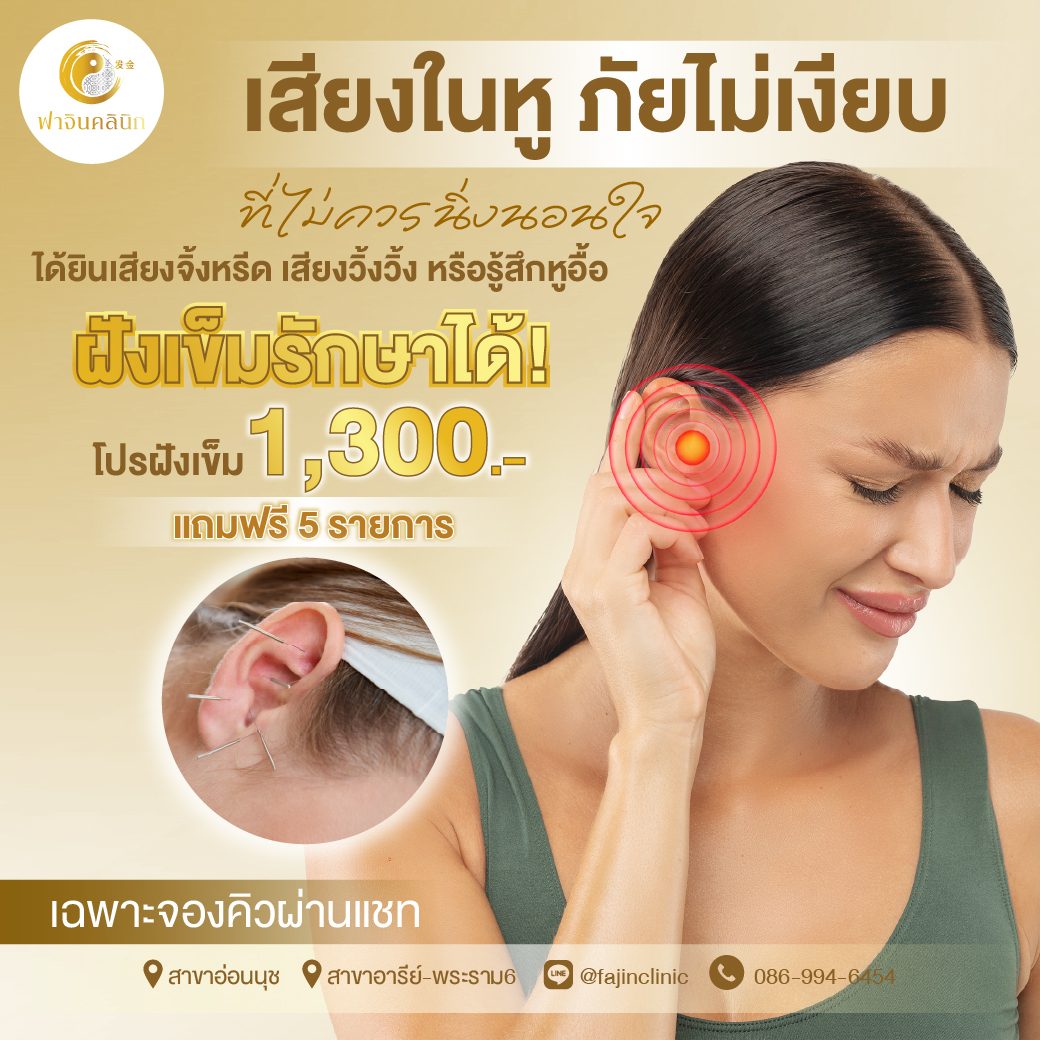 โปรโมชั่น ฝังเข็ม ฝังเข็มรักษาโรค เสียงในหู เสียงจิ้งหรีด หูอื้อ
