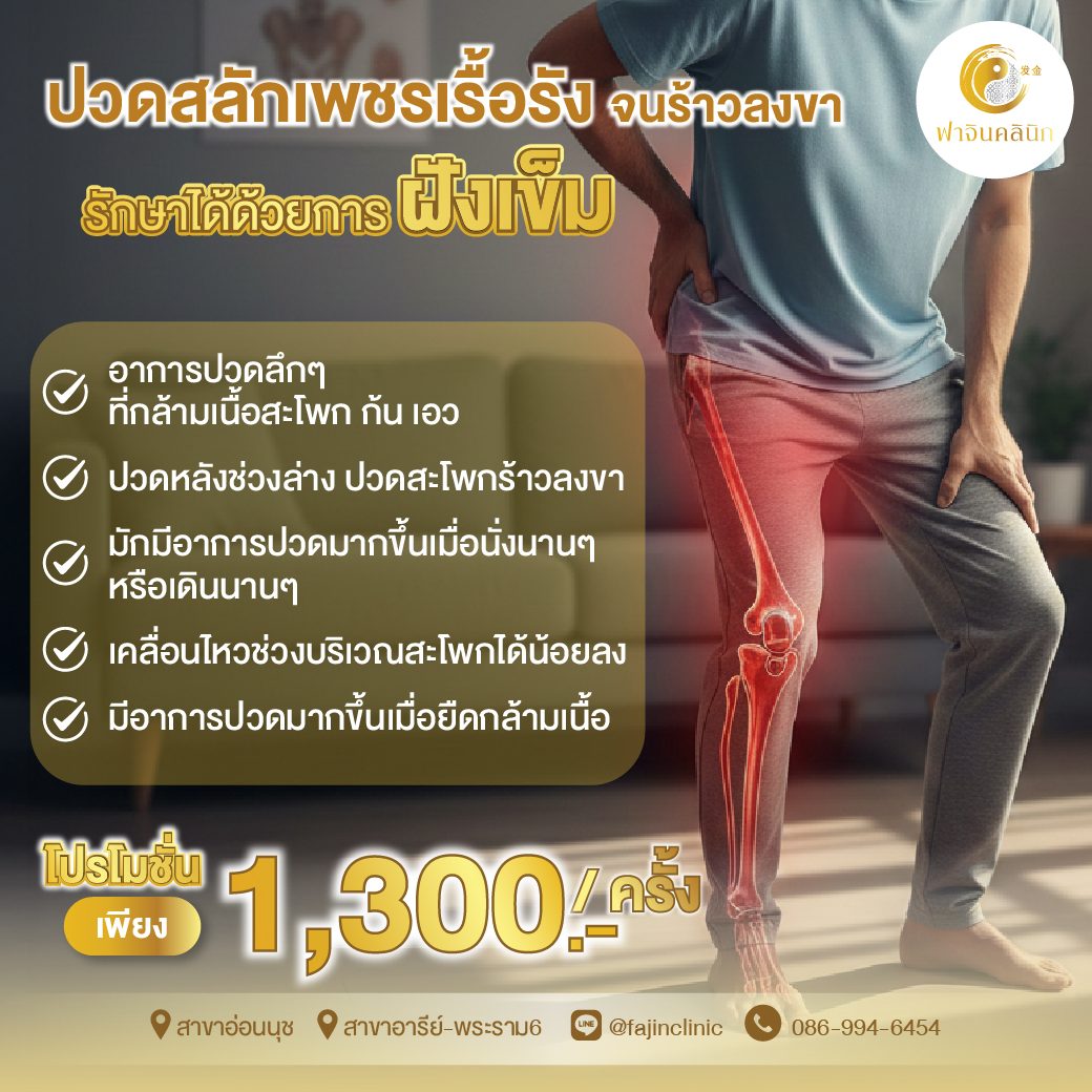 โปรโมชั่น ฝังเข็ม ฝังเข็มรักษาโรค สลักเพชร แก้ปวด