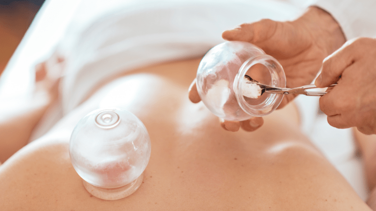 ครอบแก้ว ขับลม ท้องอืด แพทย์แผนจีน ปรับสมดุล