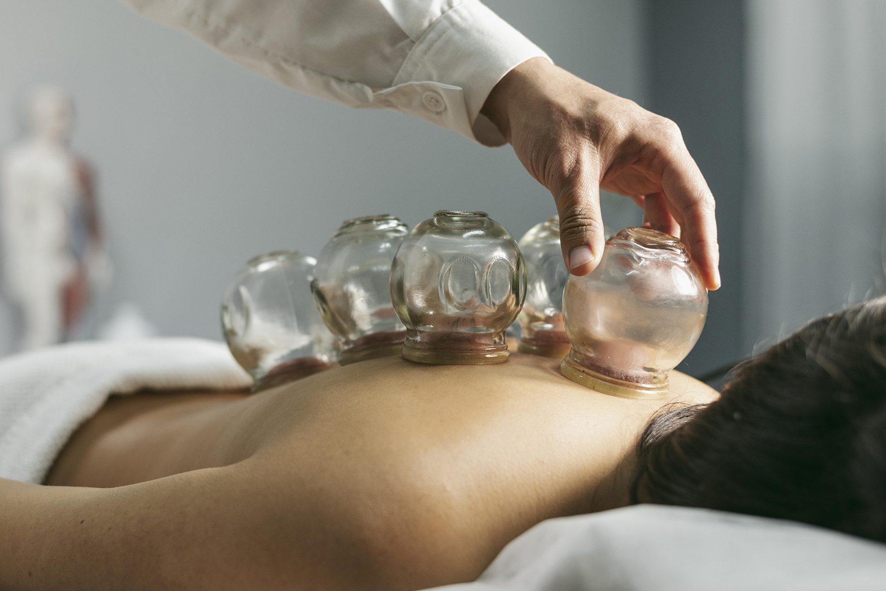 cupping on the back to pain therapy by cupping service